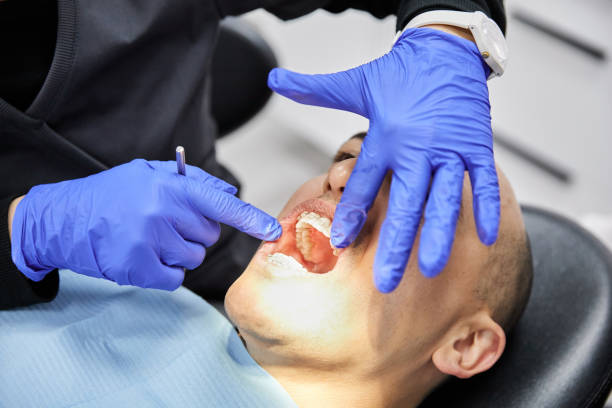 Best Emergency Broken Tooth Repair in Buchanan, MI