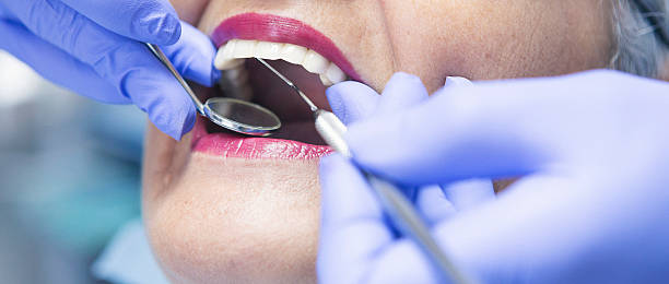 Best Emergency Root Canal Treatment in Buchanan, MI